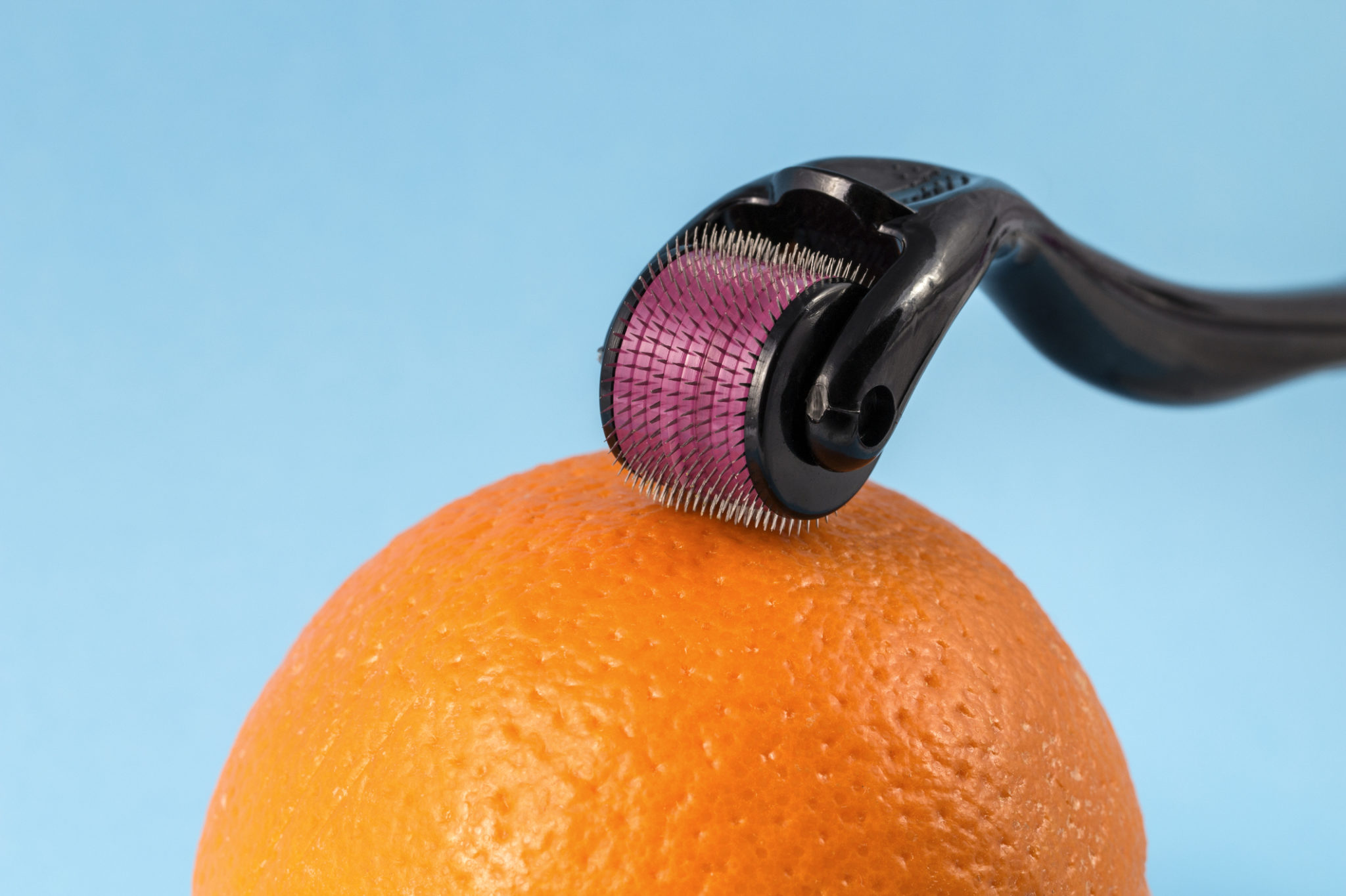 Microneedling maison dermaroller